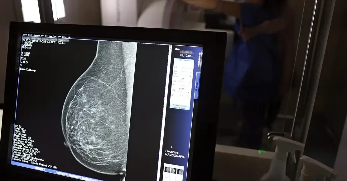 Mamografias anuais poderão ser garantidas a partir dos 40 anos