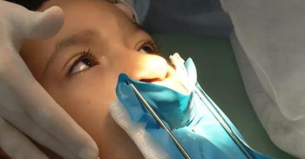 Lula sanciona lei para fornecer cirurgia para lábio leporino pelo SUS