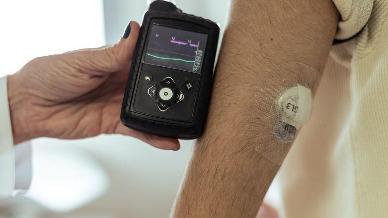Projeto na Câmara busca assegurar, pelo SUS, o fornecimento de tecnologias no tratamento da diabetes tipo 1.