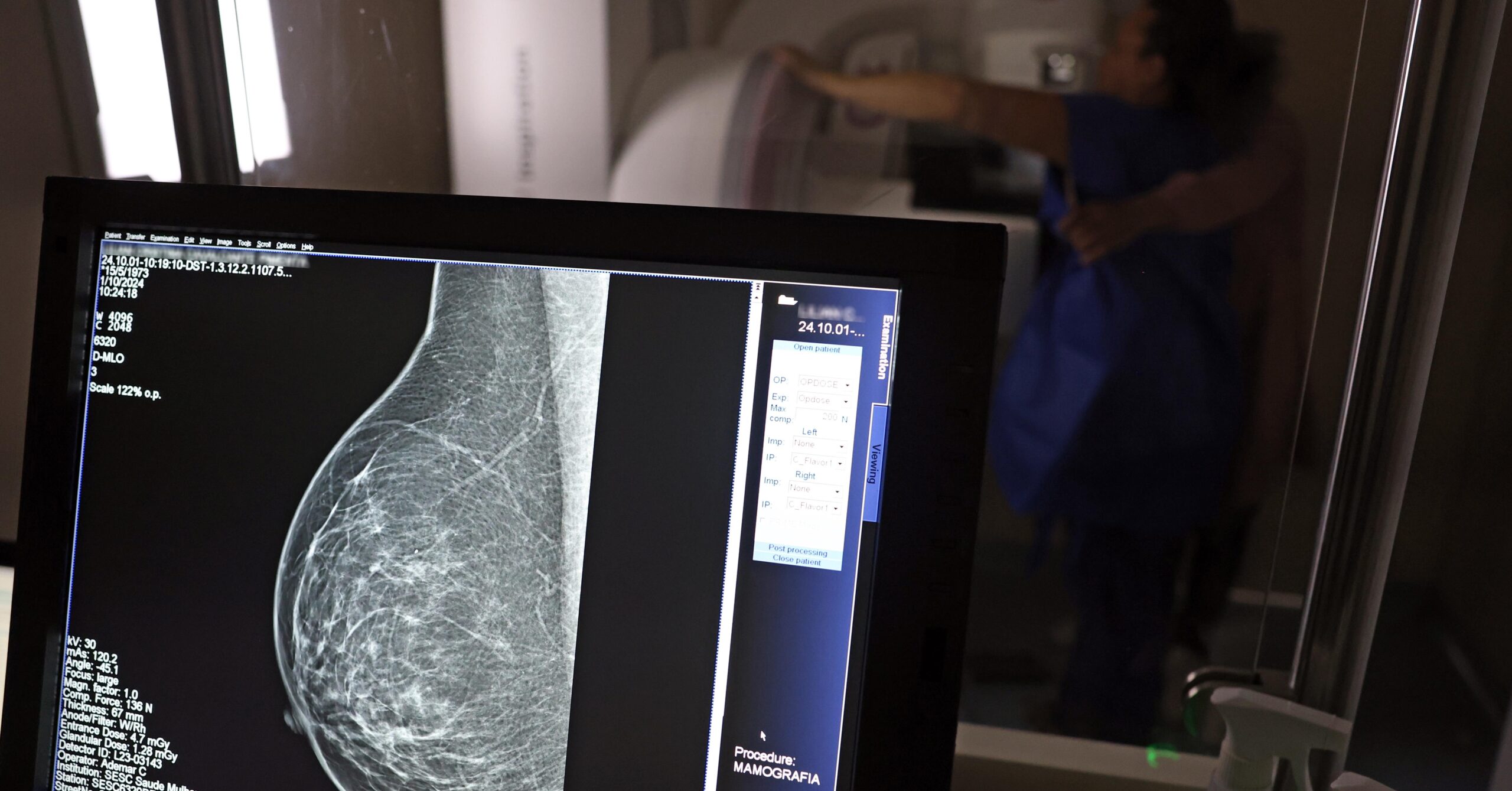 Vão à Câmara projetos que antecipam idade para mamografia no SUS