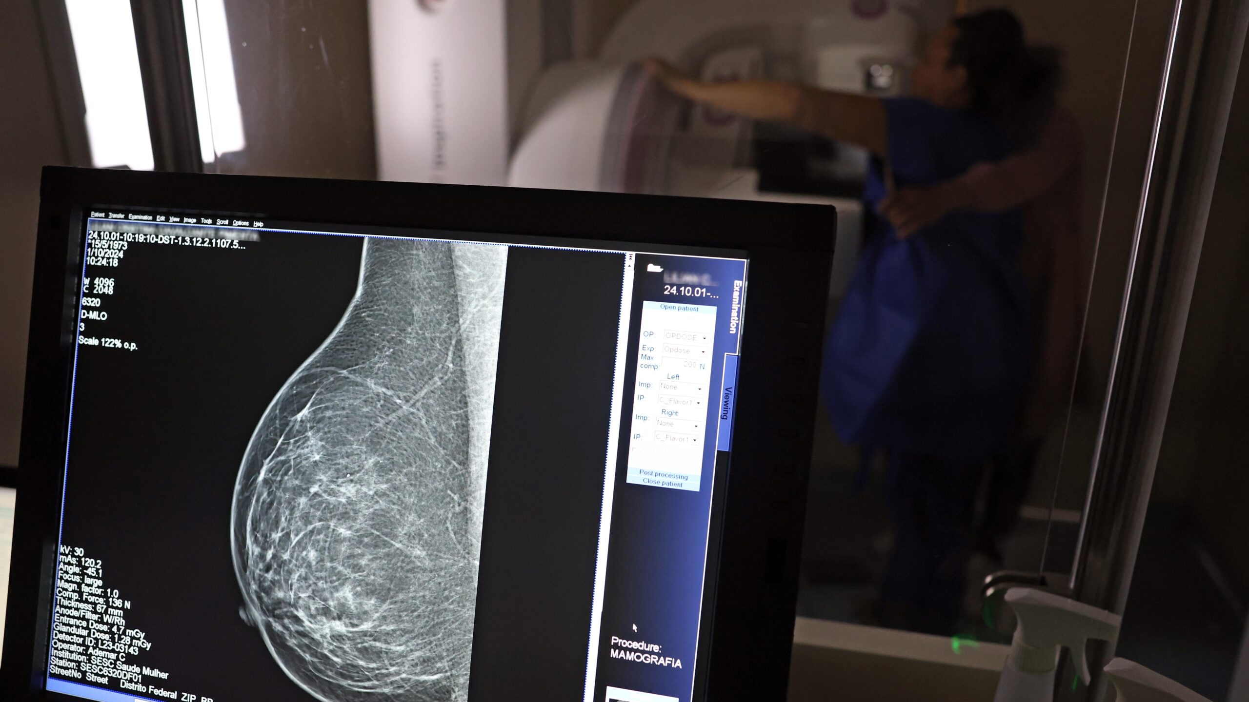 Teste de mamografia realizado na Campanha Outubro Rosa.