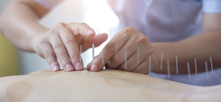 Com regras claras para exercício profissional, Lei da Acupuntura traz avanços que garantem mais segurança aos pacientes
