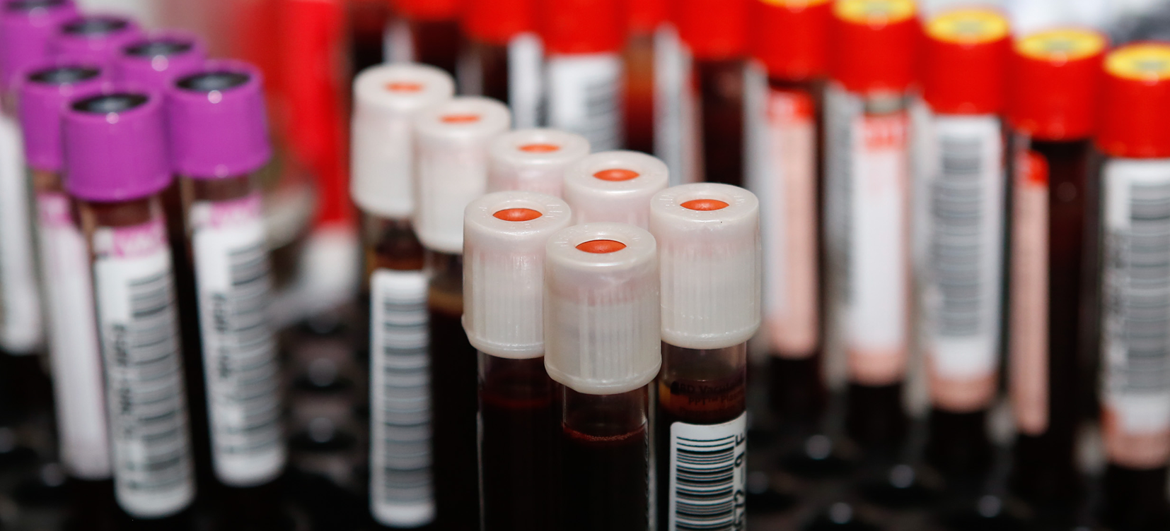 Hemope realiza campanha de doação de sangue no TRF5 
		Última atualização:  01/06/2026 às 15:36:00
